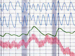 Polygraph Chart Definition